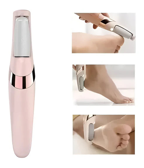Feet Cute™ Removedor de Callos Eléctrico Premium