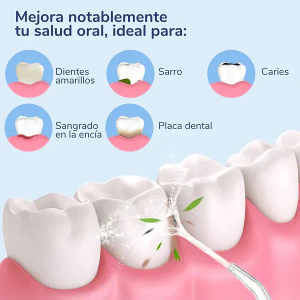 AquaBucalClean™ Irrigador Bucal Recargable Limpieza Dental Profunda Incluye 4 Boquillas de Regalo 🎁